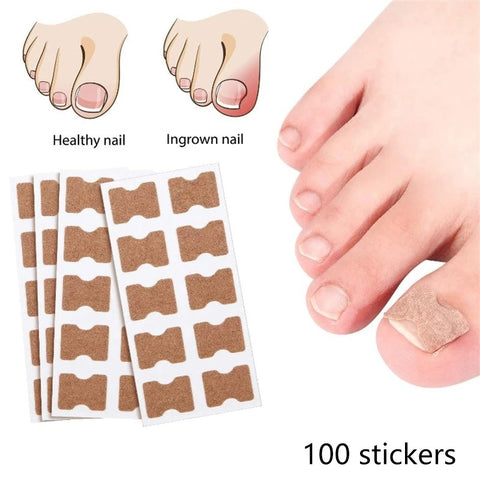 Set plasturi pentru ciuperca unghiei (100 buc)